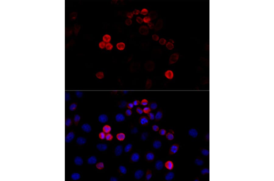 Immunofluorescence - Anti-Filamin A Antibody (A91597) - Antibodies.com