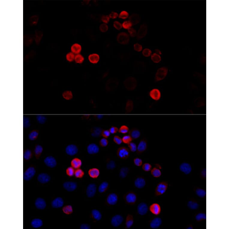 Immunofluorescence - Anti-Filamin A Antibody (A91597) - Antibodies.com