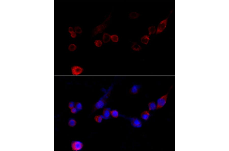 Immunofluorescence - Anti-Filamin A Antibody (A91597) - Antibodies.com