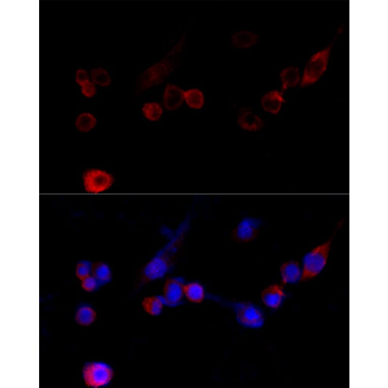 Immunofluorescence - Anti-Filamin A Antibody (A91597) - Antibodies.com