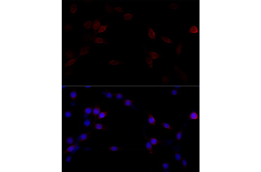 Immunofluorescence - Anti-Filamin A Antibody (A91597) - Antibodies.com