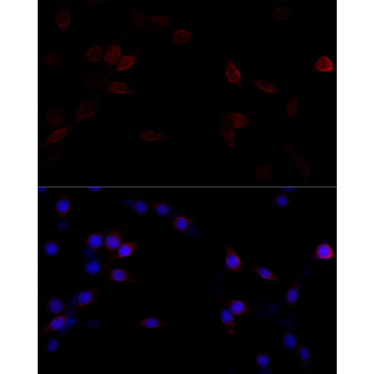 Immunofluorescence - Anti-Filamin A Antibody (A91597) - Antibodies.com