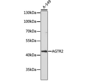 Western Blot - Anti-Angiotensin II Type 2 Receptor Antibody (A91598) - Antibodies.com