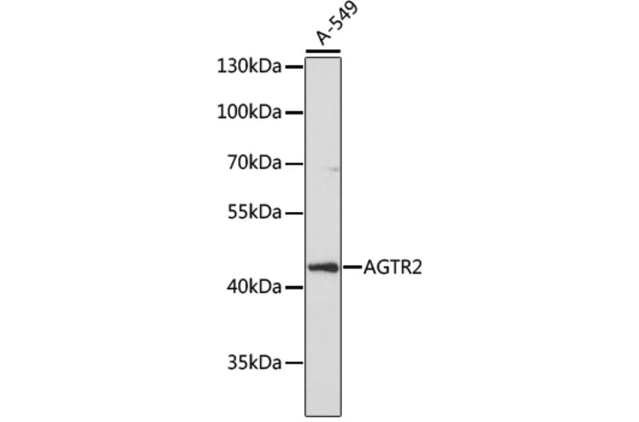 Western Blot - Anti-Angiotensin II Type 2 Receptor Antibody (A91598) - Antibodies.com