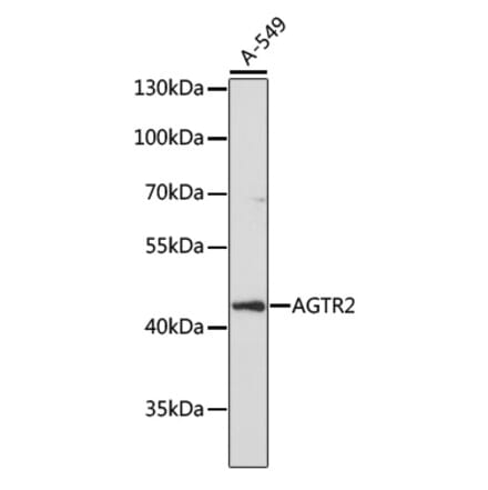 Western Blot - Anti-Angiotensin II Type 2 Receptor Antibody (A91598) - Antibodies.com