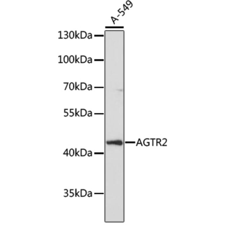 Western Blot - Anti-Angiotensin II Type 2 Receptor Antibody (A91598) - Antibodies.com