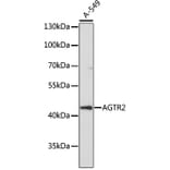 Western Blot - Anti-Angiotensin II Type 2 Receptor Antibody (A91598) - Antibodies.com