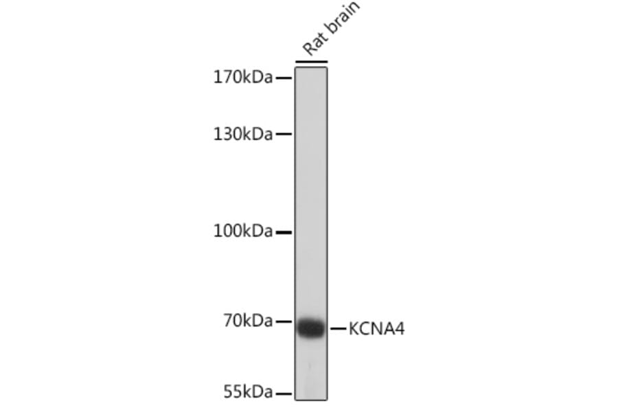 Western Blot - Anti-Kv1.4/RK3 Antibody (A91601) - Antibodies.com