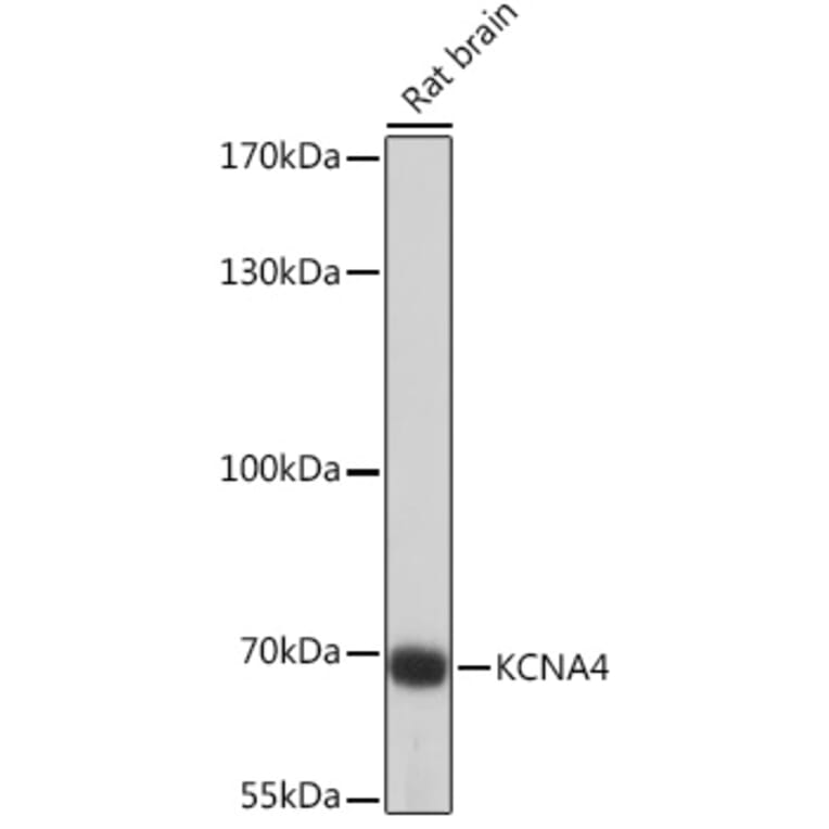 Western Blot - Anti-Kv1.4/RK3 Antibody (A91601) - Antibodies.com