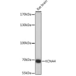 Western Blot - Anti-Kv1.4/RK3 Antibody (A91601) - Antibodies.com