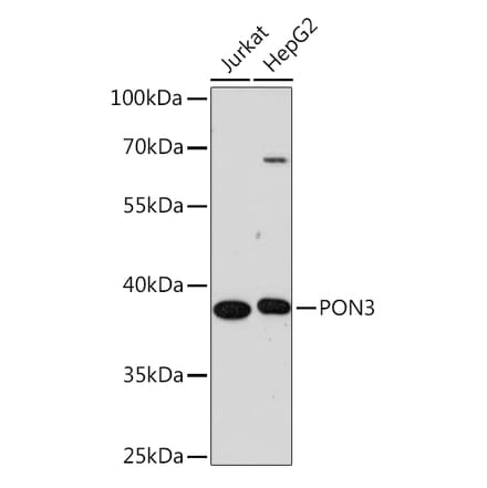 Western Blot - Anti-PON3 Antibody (A91602) - Antibodies.com