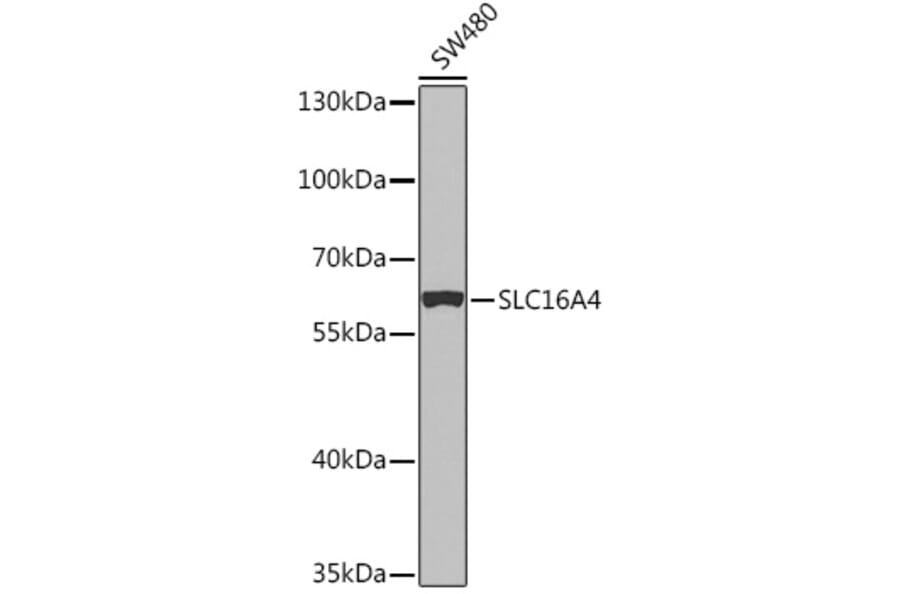 Western Blot - Anti-SLC16A4/MCT 5 Antibody (A91603) - Antibodies.com