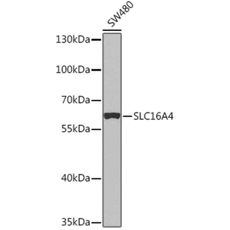 Western Blot - Anti-SLC16A4/MCT 5 Antibody (A91603) - Antibodies.com