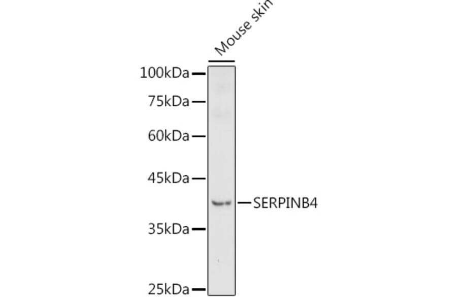 Western Blot - Anti-SerpinB4/SCCA-2 Antibody (A91605) - Antibodies.com