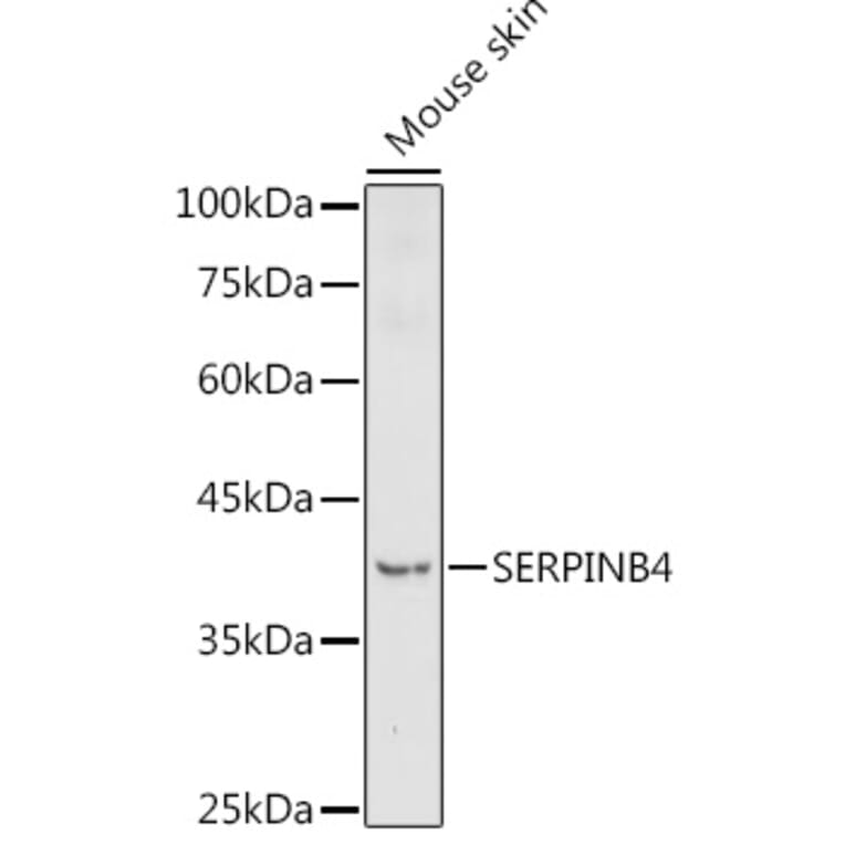 Western Blot - Anti-SerpinB4/SCCA-2 Antibody (A91605) - Antibodies.com