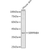 Western Blot - Anti-SerpinB4/SCCA-2 Antibody (A91605) - Antibodies.com