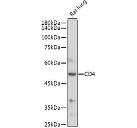 Western Blot - Anti-CD4 Antibody (A91607) - Antibodies.com