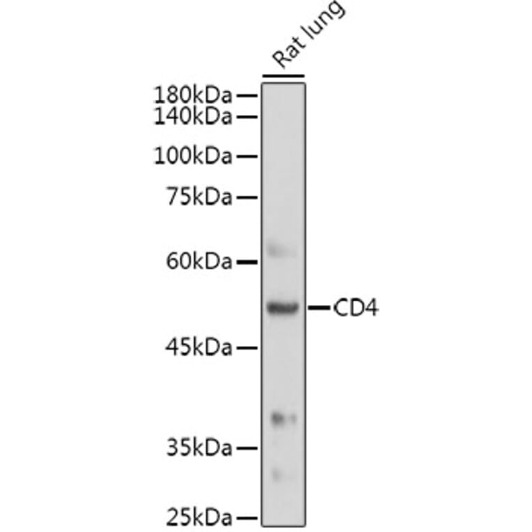 Western Blot - Anti-CD4 Antibody (A91607) - Antibodies.com