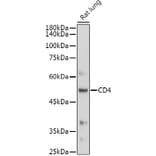 Western Blot - Anti-CD4 Antibody (A91607) - Antibodies.com