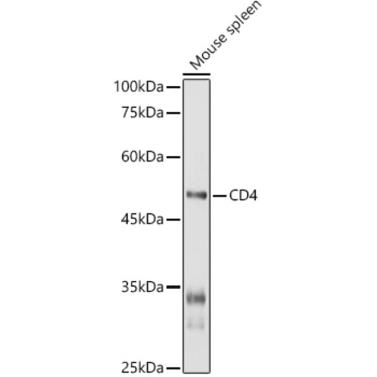 Western Blot - Anti-CD4 Antibody (A91607) - Antibodies.com