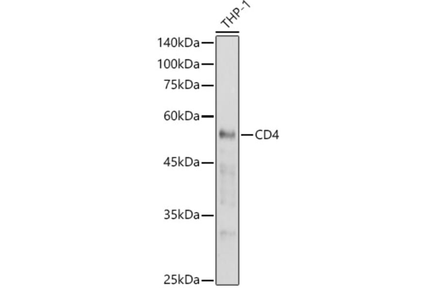 Western Blot - Anti-CD4 Antibody (A91607) - Antibodies.com