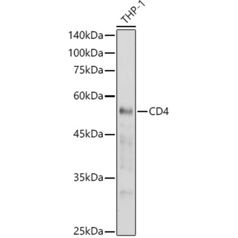 Western Blot - Anti-CD4 Antibody (A91607) - Antibodies.com