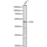 Western Blot - Anti-CD4 Antibody (A91607) - Antibodies.com
