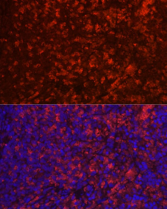 Anti-CD4 Antibody (A91607) | Antibodies.com
