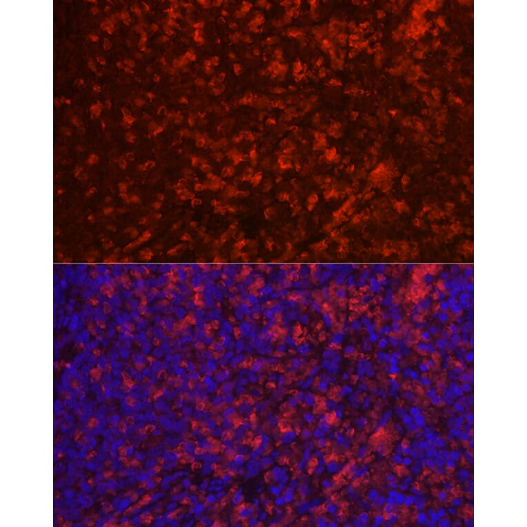 Immunofluorescence - Anti-CD4 Antibody (A91607) - Antibodies.com