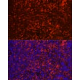 Immunofluorescence - Anti-CD4 Antibody (A91607) - Antibodies.com
