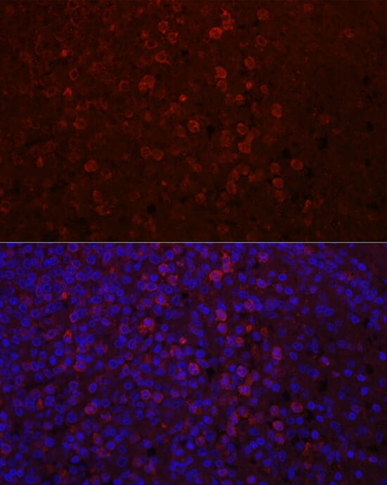Anti-CD4 Antibody (A91607) | Antibodies.com
