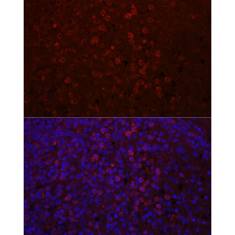Immunofluorescence - Anti-CD4 Antibody (A91607) - Antibodies.com