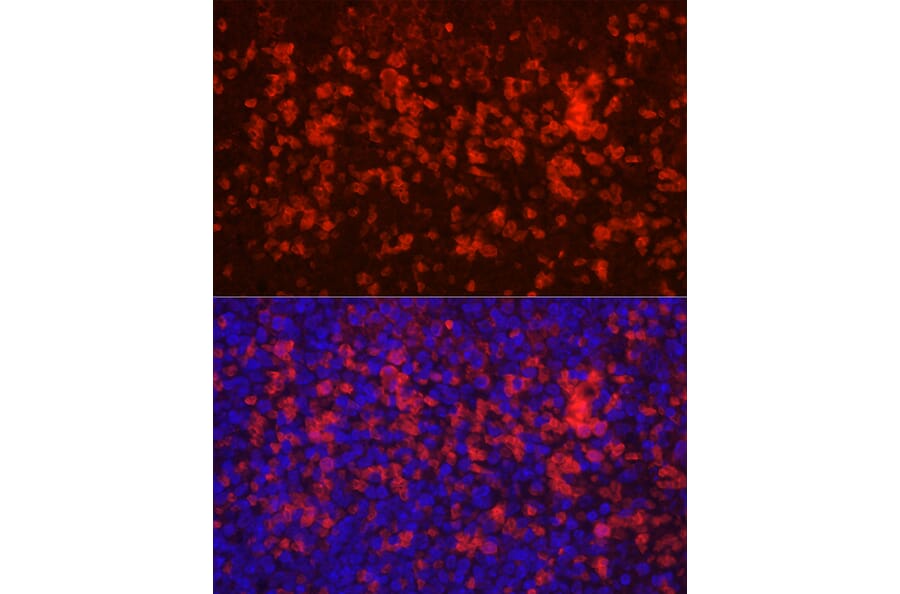 Immunofluorescence - Anti-CD4 Antibody (A91607) - Antibodies.com