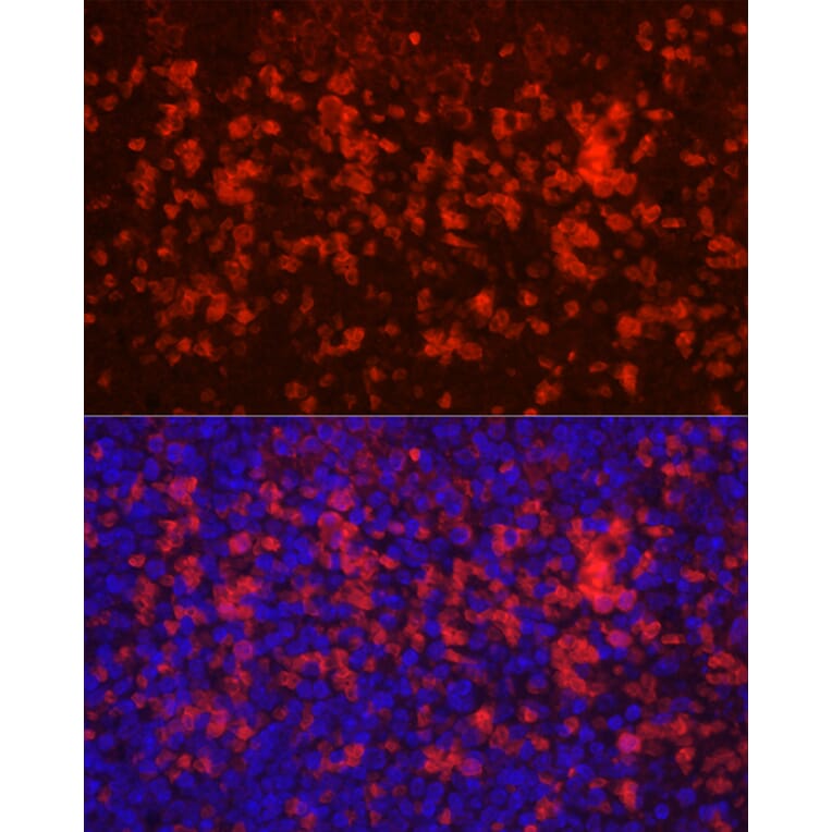 Immunofluorescence - Anti-CD4 Antibody (A91607) - Antibodies.com