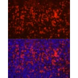 Immunofluorescence - Anti-CD4 Antibody (A91607) - Antibodies.com