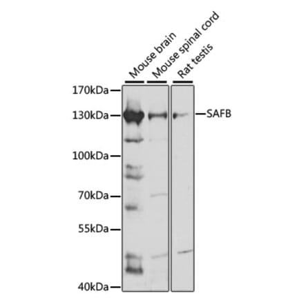 Western Blot - Anti-SAFB Antibody (A91609) - Antibodies.com