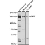 Western Blot - Anti-SAFB Antibody (A91609) - Antibodies.com