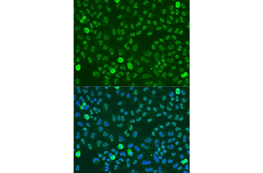 Immunofluorescence - Anti-SAFB Antibody (A91609) - Antibodies.com