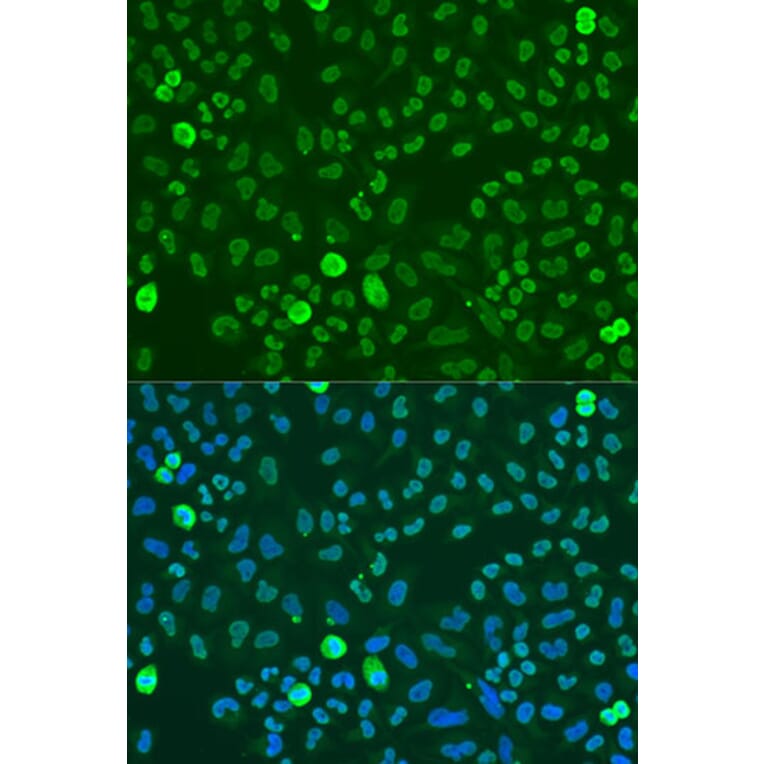 Immunofluorescence - Anti-SAFB Antibody (A91609) - Antibodies.com