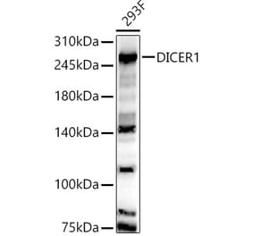 Western Blot - Anti-Dicer Antibody (A91611) - Antibodies.com