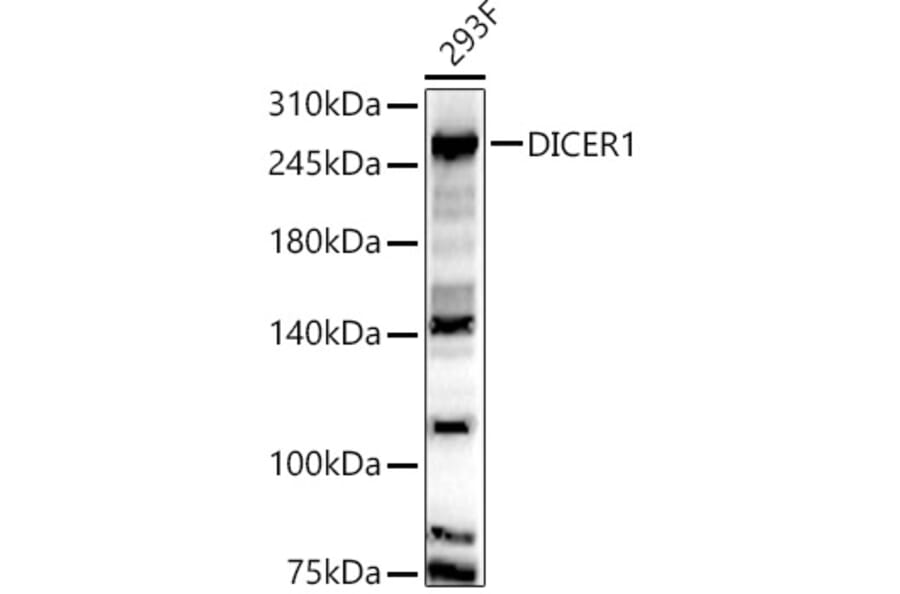 Western Blot - Anti-Dicer Antibody (A91611) - Antibodies.com