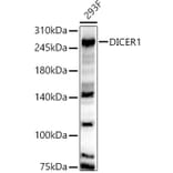 Western Blot - Anti-Dicer Antibody (A91611) - Antibodies.com
