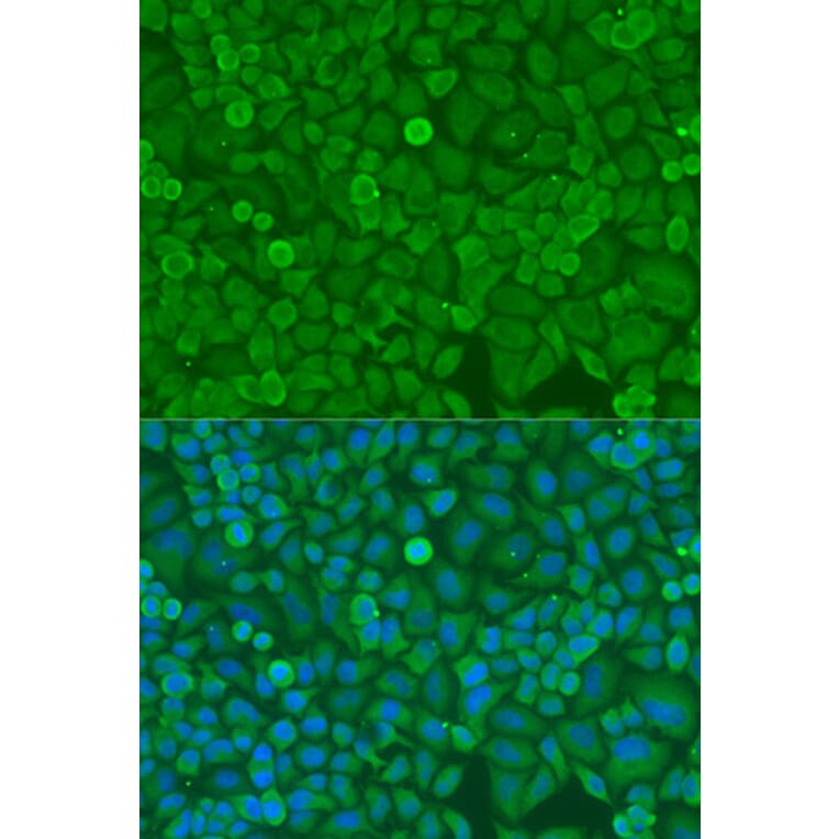 Immunofluorescence - Anti-Dicer Antibody (A91611) - Antibodies.com