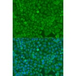 Immunofluorescence - Anti-Dicer Antibody (A91611) - Antibodies.com
