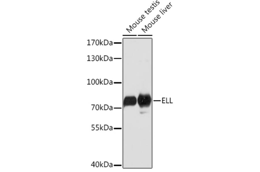 Western Blot - Anti-ELL Antibody (A91613) - Antibodies.com