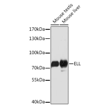Western Blot - Anti-ELL Antibody (A91613) - Antibodies.com