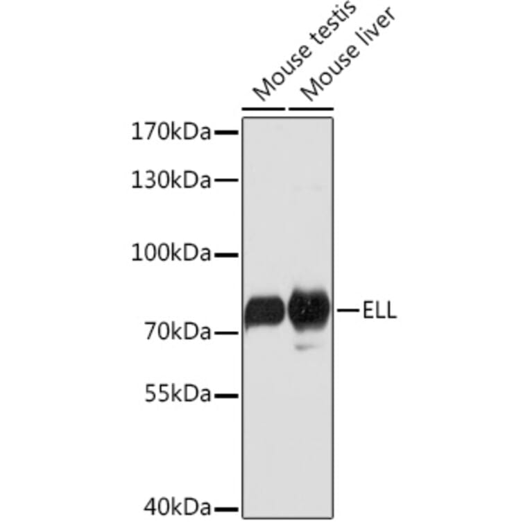 Western Blot - Anti-ELL Antibody (A91613) - Antibodies.com