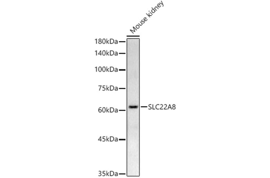 Western Blot - Anti-OAT3 Antibody (A91617) - Antibodies.com