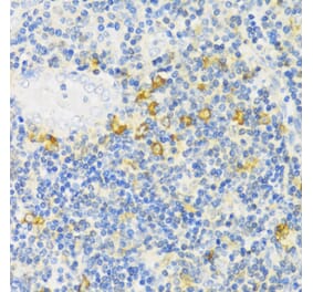 Immunohistochemistry - Anti-MLKL Antibody (A91618) - Antibodies.com