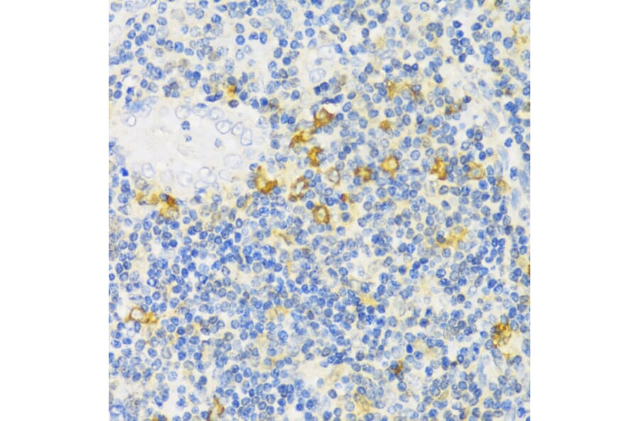 Immunohistochemistry - Anti-MLKL Antibody (A91618) - Antibodies.com
